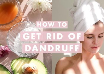 How to Get Rid of Dandruff | Home Remedies