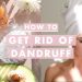 How to Get Rid of Dandruff | Home Remedies